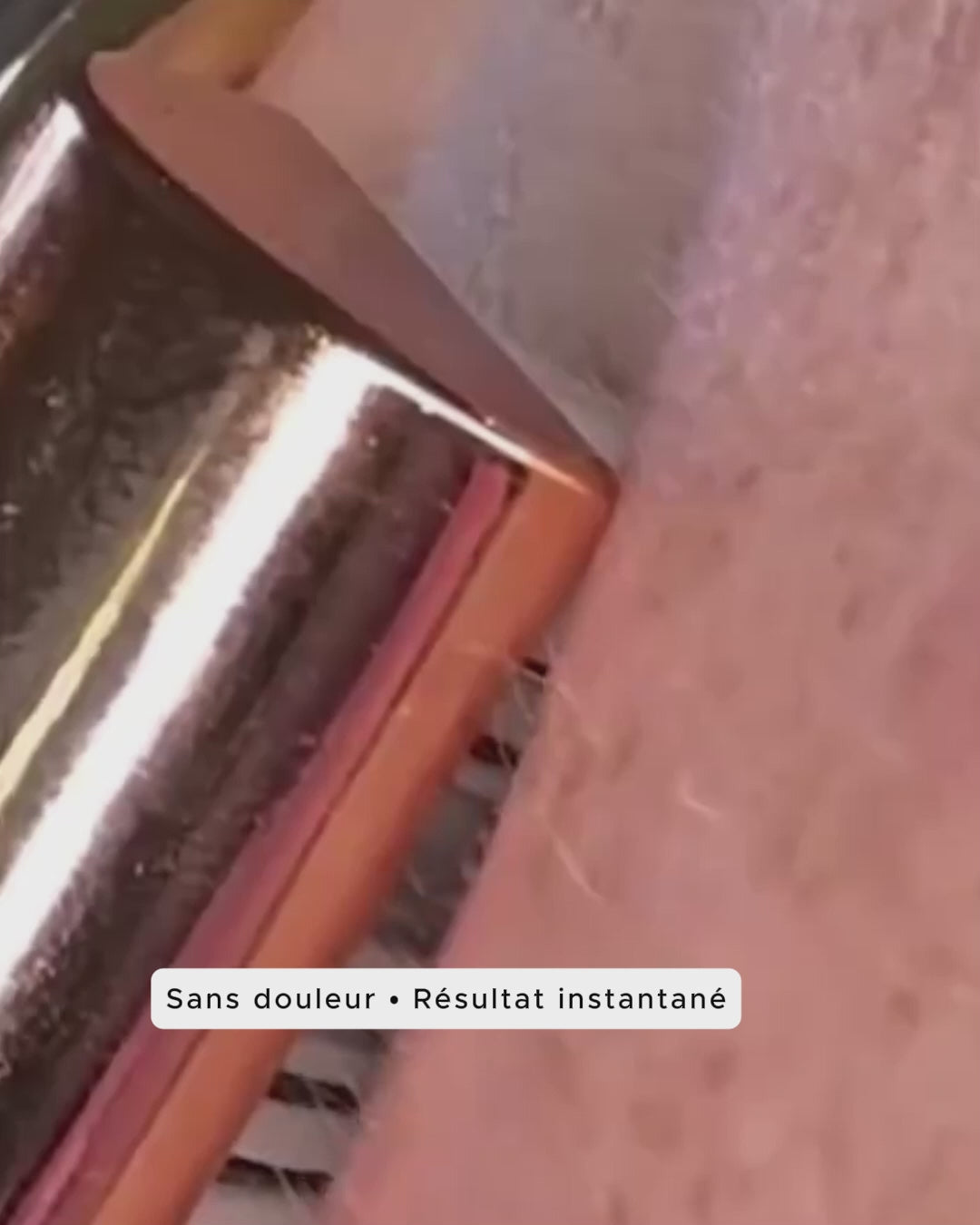 Dermalisse™ - Une épilation du visage douce pour une peau lisse et lumineuse